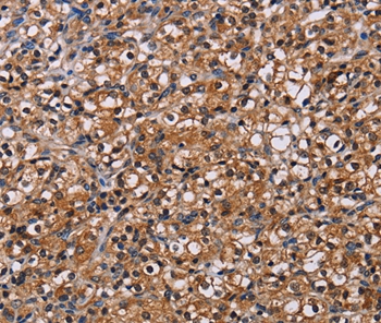 NPM3 Antibody