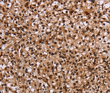 HMGN5 Antibody