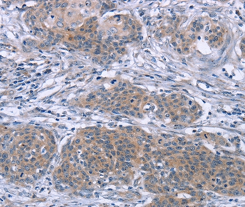 PDLIM2 Antibody