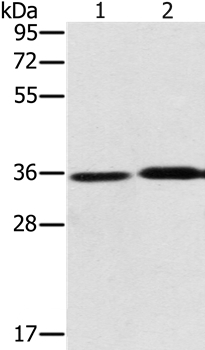 PHYH Antibody