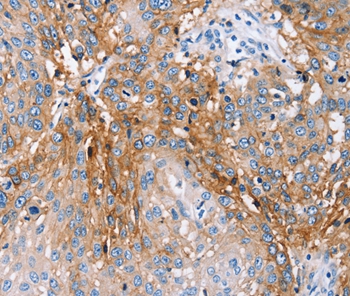 PLCZ1 Antibody