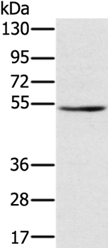 TMPRSS2 Antibody