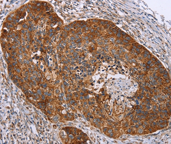 RMDN3 Antibody