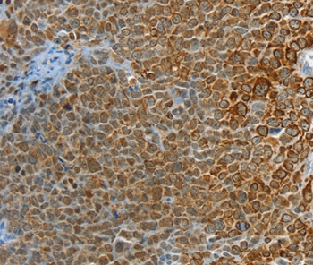 PTPN3 Antibody