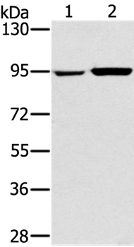 PYGL Antibody