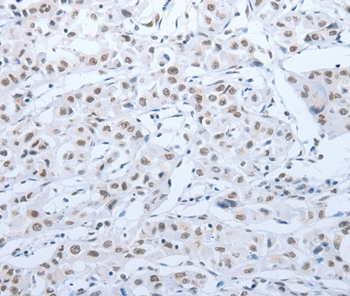 ACIN1 Antibody