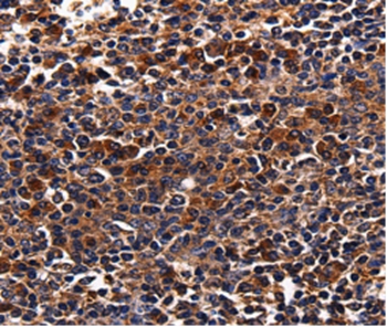 ADRB1 Antibody