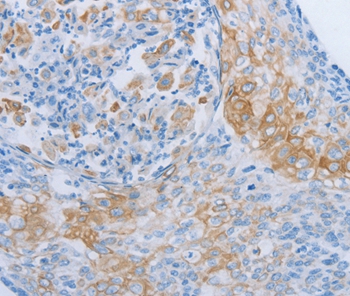 ADRB3 Antibody