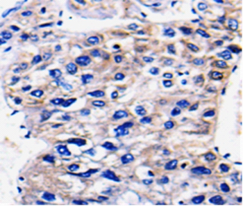 RAB35 Antibody