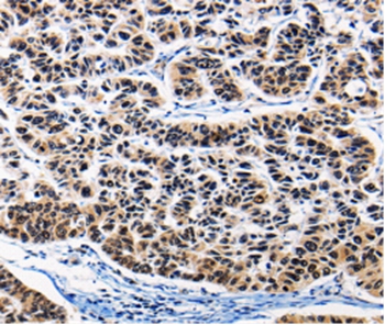 AP1B1 Antibody