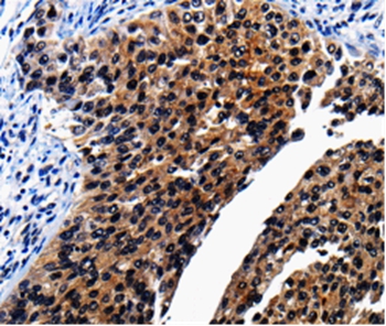 AP1B1 Antibody