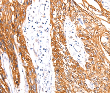 RAB3D Antibody