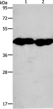 CKM Antibody