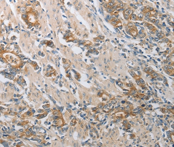 CST3 Antibody