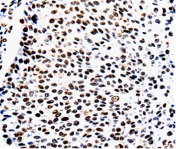 AQP2 Antibody