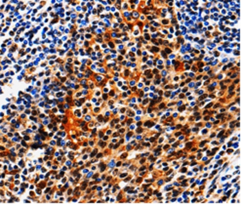 AQP2 Antibody