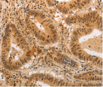 ADRA1B Antibody