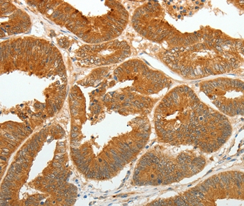 ASCL1 Antibody