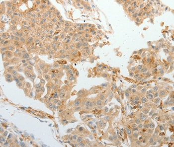 ASCL1 Antibody