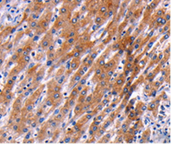 PPP1R13B Antibody