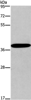 CCR2 Antibody