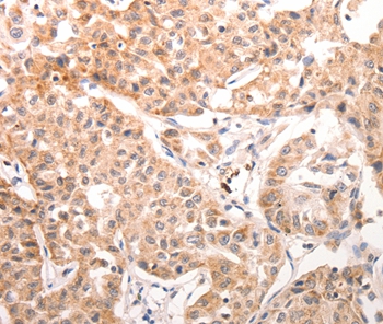 CCR3 Antibody