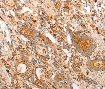 CDKN1C Antibody