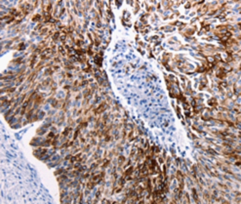 KRT14 Antibody