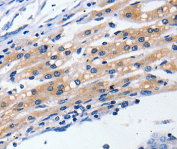 CLDN5 Antibody