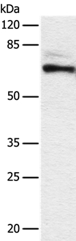 DPYSL2 Antibody