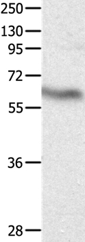 DPYSL4 Antibody