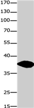 GJD2 Antibody