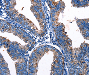 Gjc3 Antibody