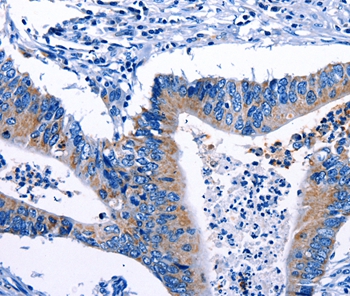 Gjc3 Antibody