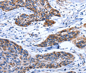 AQP8 Antibody