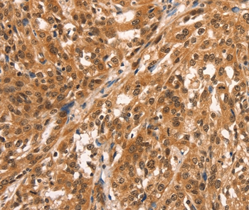 CCNE2 Antibody