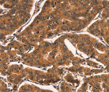 CCNE2 Antibody