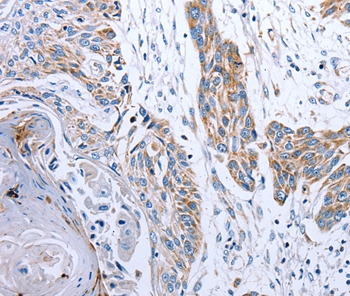 NDUFA12 Antibody