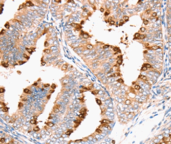 DNMT1 Antibody