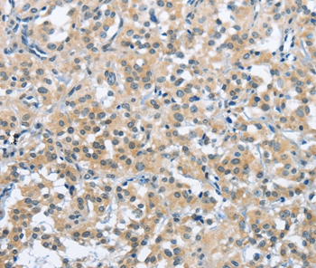 TRDMT1 Antibody