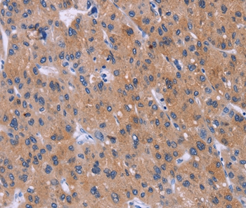 DVL2 Antibody