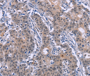 DVL2 Antibody