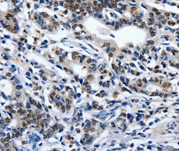 ENPP3 Antibody