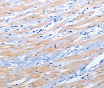 EPHA1 Antibody