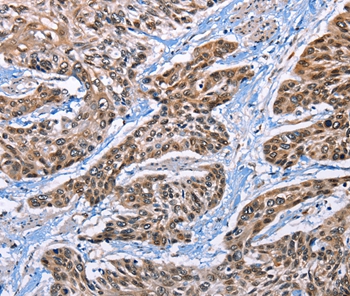 EPHA4 Antibody