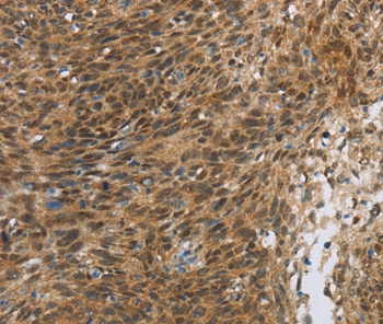 FOXB1 Antibody