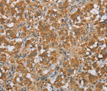 FOXB1 Antibody