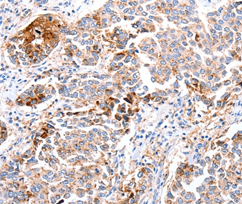 FOXD2 Antibody