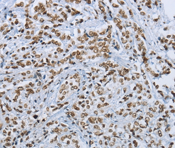 FOXE1  Antibody