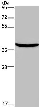 FOXE1  Antibody